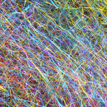 使用三維顯微造影新技術下呈現的人類運動皮層神經元環路。